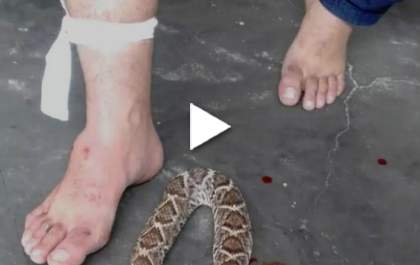 Ex-vereador é picado por uma cobra enquanto pescava