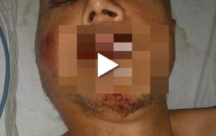 Deficiente é espancado por dois homens e encontrado nu