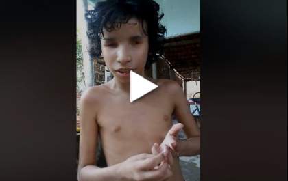 Menino com deficiência visual pede ajuda para fazer cirurgia e poder ver sua banda favorita