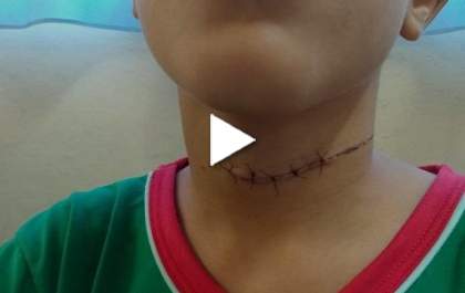 Pais de garoto ferido com linha chilena revelam o desespero que eles viveram