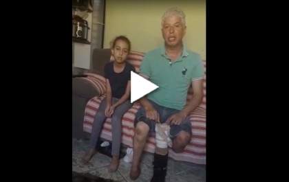 Homem que perdeu um pé e a perna esquerda em acidente precisa de ajuda para trocar prótese