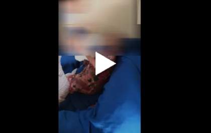 Filho grava a esposa agredindo a mãe de 82 anos