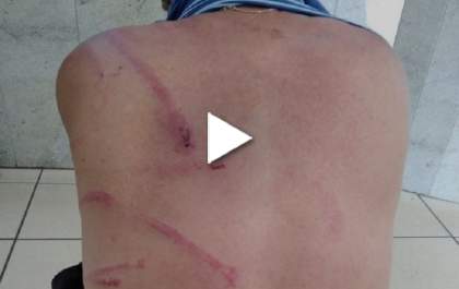 Mulher é denunciada por agressão após morder e arranhar marido