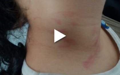Grávida é agredida por amante do marido ao ver os dois na cama