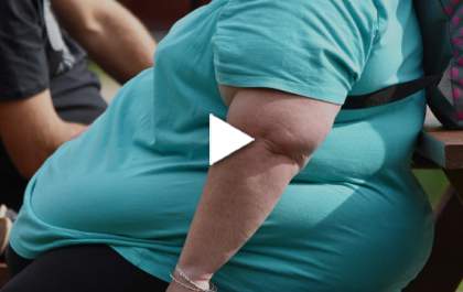 Medssim - Confira dados sobre a obesidade e entendas os graus da doença