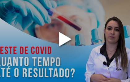 Quanto tempo para sair o resultado do teste da covid? Lab Life explica