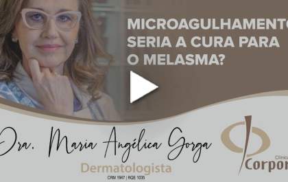 Microagulhamento seria a cura para o Melasma?