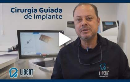 Libert Odontologia -Técnica de cirurgia guiada de implante