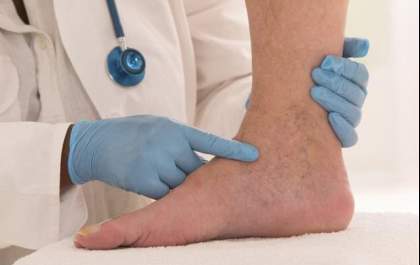 Pessoas com Diabetes precisam tomar muito cuidado com os pés. Entenda:
