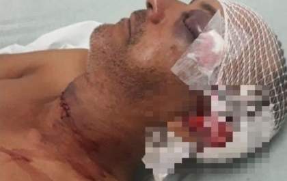 Homem é gravemente ferido ao tentar impedir estupro de grávida