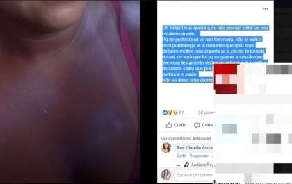 Mulher sofre queimaduras graves após sessão de bronzeamento natural
