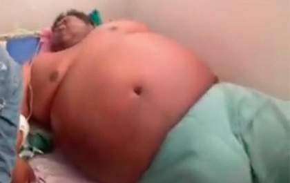 Homem de 280kg espera há dois meses por cama em hospital