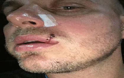 Vereador e seu filho são acusados de agredir educador