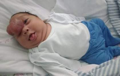 Oportunistas usam imagem de bebê com doenças raras para arrecadar dinheiro