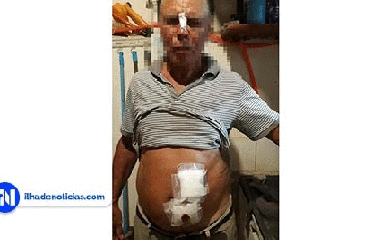 Idoso leva dez pontos no nariz e barriga após ataque de pitbull