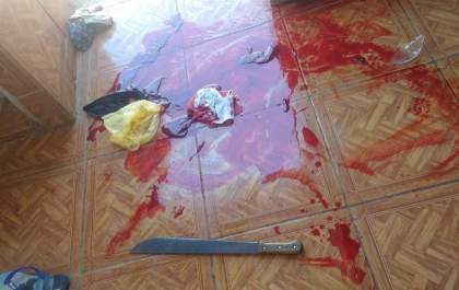Filho ataca o pai com golpes de facão