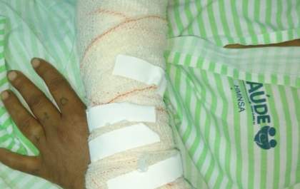 Alegando ciúme, homem ateia fogo no corpo da companheira&nbsp;