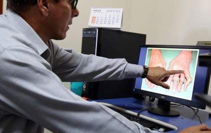 Primeiro caso de Chikungunya de 2019 é confirmado em TL