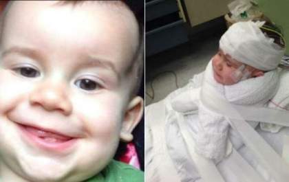 Alerta: Namorada do pai deixa criança com 'Síndrome do Bebê Sacudido'