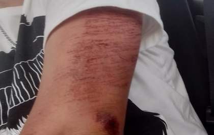 Motociclista pede ajuda para encontrar motorista que o atropelou