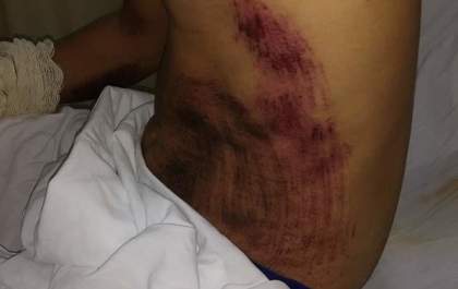 Motociclista atropelado pede ajuda para localizar autor de acidente&nbsp;