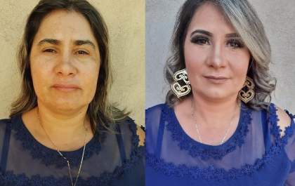 Maquiadora eleva autoestima de mulheres que tem manchas no rosto