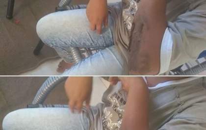 Criança é atacada por homem no bairro Guanabara em TL