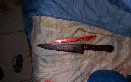 Mulher corta pênis do próprio irmão