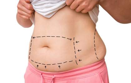 Brasil é o 2º país que mais realiza a cirurgia bariátrica