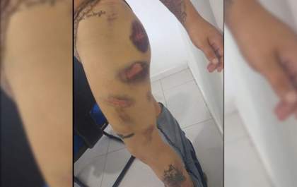 Jovem é preso após torturar ex-namorada e a obrigar a comer fezes