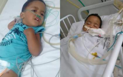 Bebê sofre paralisia cerebral após engasgar com pedaço de maça&nbsp;