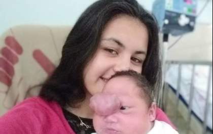 Morre o pequeno Natanael, criança que nasceu com quatro doenças raras