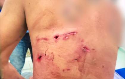 Homem atacado por onça-pintada é salvo por cinco cachorros