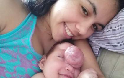 Mãe informa morte de Natanael, o&nbsp; bebê que nasceu com 4 doenças raras