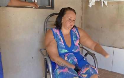 Homem é condenado a 15 anos de prisão por decepar as duas mãos da ex-mulher