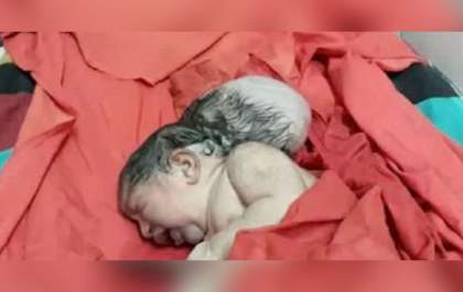 Pai tenta enterrar filha viva que nasceu com três cabeças