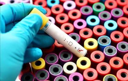 Homem deve ser indenizado por falso positivo para HIV