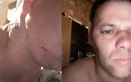 Motociclista é atingido por linha chilena no Jardim Nova Americana&nbsp;&nbsp;