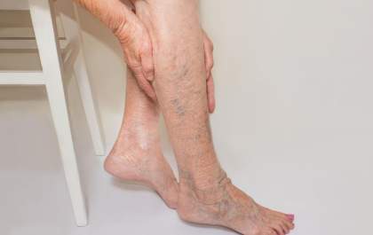 Dicas para prevenir doenças vasculares pioradas pelo frio
