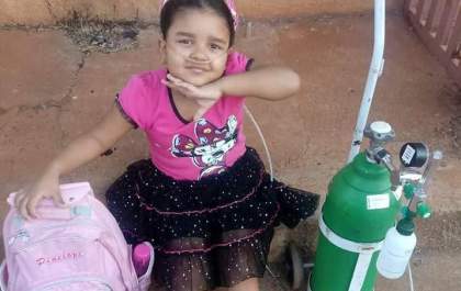 Samila que nasceu com doença rara mostra exemplo de superação