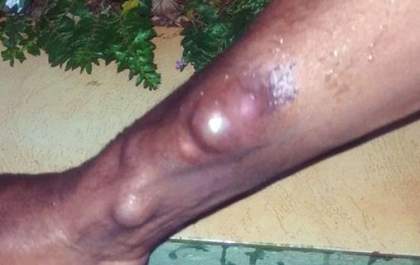 Irmã faz apelo para conseguir cirurgia com urgência para Claudinho