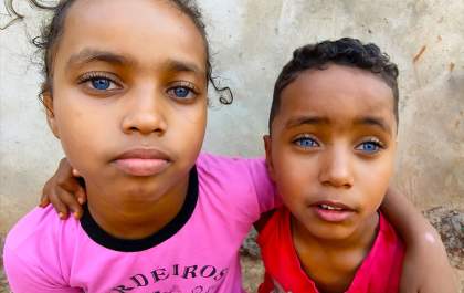 Irmãos de olhos azuis em Planalto ainda vivem em situação crítica: vamos ajudar!