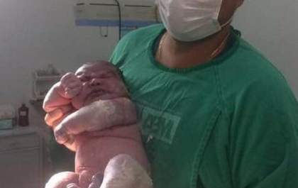 Bebê 'gigante': criança nasce com 6 quilos e mais de meio metro