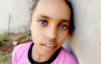 Irmãos dos olhos cor de safira que estão encantando a internet precisam de doações