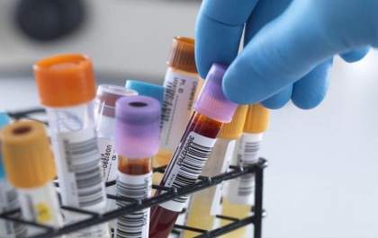 A importância do laboratório de análises clínicas para a população