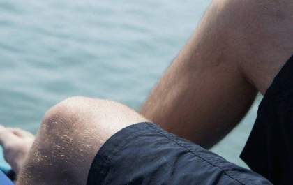 Homens tem índice maior que as mulheres em relação ao surgimento de trombose arterial