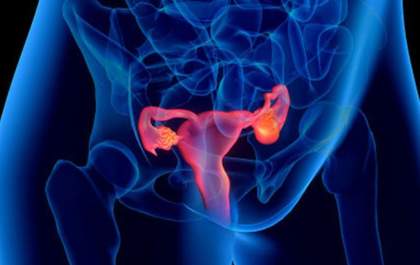 Técnica minimamente invasiva para o tratamento de Mioma Uterino. Conheça: