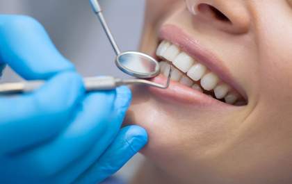 Tire suas dúvidas sobre implantes e tratamentos dentários