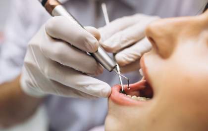Endodontia: especialidade que cuida da raiz dos problemas dentários