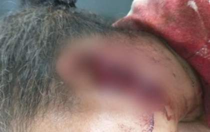 Homem é preso após decepar orelha da esposa com facão
